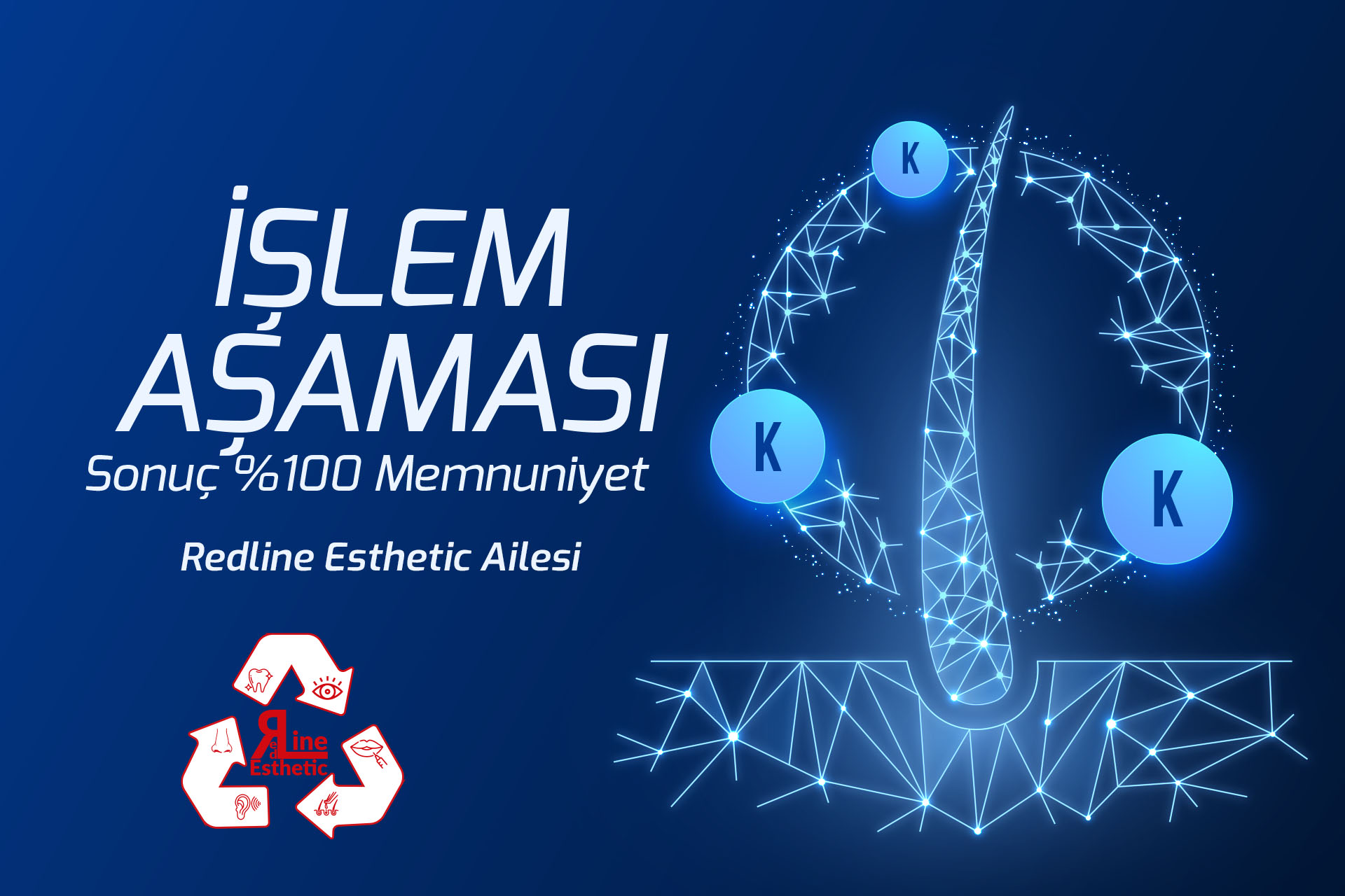 İşlem Aşaması